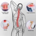 Multi-level Back Stretcher and Pain Reliever | Lumbar Support | Lower and Upper Back Muscle Pain Relief - Image 5